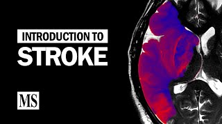 Introduction To Stroke [upl. by Langbehn556]