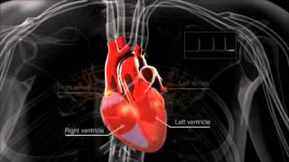 What is atrial fibrillation [upl. by Delainey]