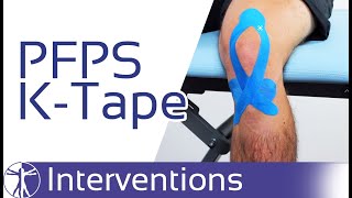 Kinesio Taping for PFPS  Patellofemoral Pain Syndrome [upl. by Pawsner]