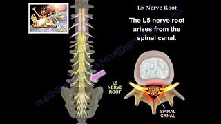 Sciatica  Everything You Need To Know  Dr Nabil Ebraheim [upl. by Anairotciv621]