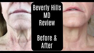 Beverly Hills MD Dermal Repair Complex—Lift and Firm Sculpting Cream—Before and After—AntiAging [upl. by Anelec]