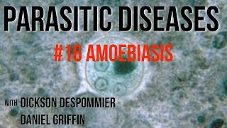 Parasitic Diseases Lectures 16 Amoebiasis [upl. by Cain]