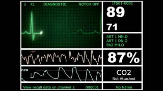 Hospital Monitor with FlatLine L HD [upl. by Khosrow]