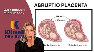 ABRUPTIO PLACENTA  questions with Dr Sharon [upl. by Mulac]