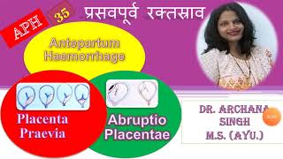 35 APH ANTEPARTUM HAEMORRHAGE  प्रसवपूर्व रक्तस्राव [upl. by Eecyal390]