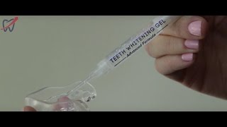 Teeth Whitening Syringe and Tray Instructions [upl. by Nickerson]