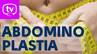 La abdominoplastia ¡todo lo que debes saber [upl. by Philips]