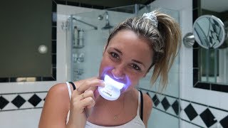 Do athome teeth whitening kits really work  Glam Lab [upl. by Ecerahc747]