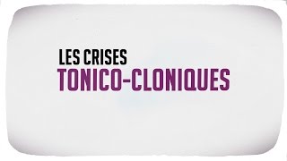 Les crises tonico cloniques [upl. by Nell]