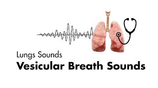 Vesicular Breath Sounds  Normal Lung Sounds  MEDZCOOL [upl. by Stranger]