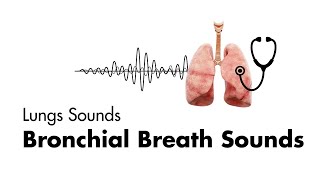 Bronchial Breath Sounds  Lung Sounds  Medzcool [upl. by Dalton647]