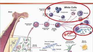 Aplastic Anemia Approach on Diagnosis and Treatment Options 2018 [upl. by Ayin397]