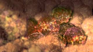 The Cancer Stem Cell Theory [upl. by Enehs]