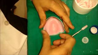 denture base preparation [upl. by Ynnot]