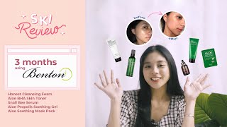 SKI REVIEW with Neza  Review Benton Selama 3 Bulan💚  Aloe Propolis Aloe BHA Skin Toner etc [upl. by Niamart]