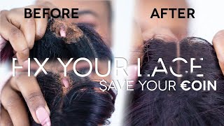 How to fix a hole in your frontal or closure FAST AND EASY Repair your frontal [upl. by Notecnirp]