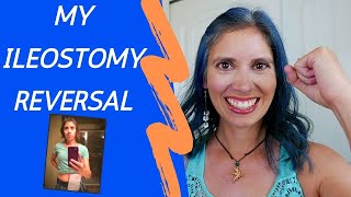 My Ileostomy Reversal Experience [upl. by Dorina]