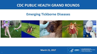 Emerging Tickborne Diseases [upl. by Waller]