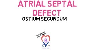 Ventricular Septal Defect VSD  Heart Auscultation  Episode 11 [upl. by Elegna]