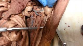 Cat Dissection Urinary System Final [upl. by Led]