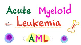 Acute Myeloid Leukemia AML  Auer Rods  Myeloperoxidase Positive  Hematology amp Oncology Series [upl. by Laleb]