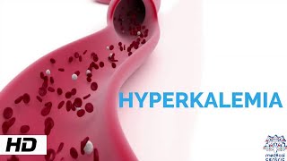 HYPERKALEMIA Causes Signs and Symptoms Diagnosis and Treatment [upl. by Hsot]