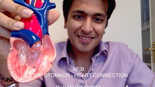 Afib The stomachheart connection [upl. by Aggappera]