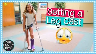 GETTING A LEG CAST FOR BROKEN FOOT  DANCE INJURY [upl. by Ayn]