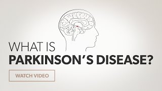 What is Parkinsons Disease [upl. by Letnom620]