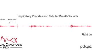 12 Cough Sound Variations in 60 Seconds [upl. by Malita]