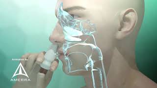 Fluticasone nasal spray Flonase  3D medical animation [upl. by Notgnirrab]