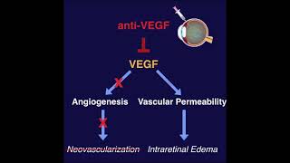 AntiVEGF for the treatment of Retinal Diseases  ANCHOR MARINA BRAVO CRUISE DRCR Protocol I [upl. by Ycram217]