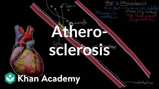 Atherosclerosis  Circulatory System and Disease  NCLEXRN  Khan Academy [upl. by Barcus]