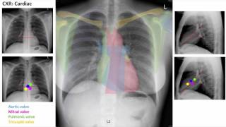 Anatomy of a Chest XRay [upl. by Nolrah71]