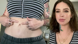 Tummy Tuck tips  Swelling Best Faja My advice  Still Glamorus [upl. by Niwhsa]