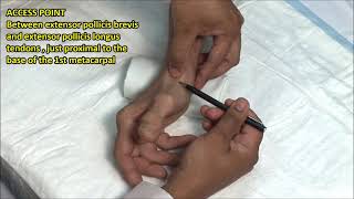 How To Self Administer Intramuscular Injections [upl. by Photima617]