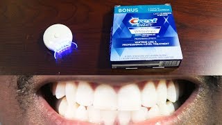 How To Whiten Teeth Easy • AuraGlow LED Light amp Crest 3D Whitestrips [upl. by Morrison]