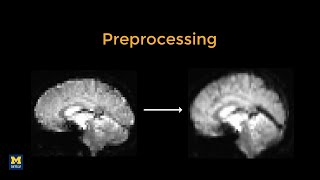 SPM Tutorial 4a Introduction to Preprocessing [upl. by Lasko290]