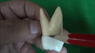 Morphology of Maxillary Permanent Second Molar [upl. by Leanard687]