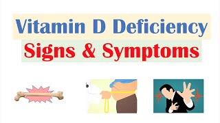 Vitamin D Deficiency Signs amp Symptoms ex Fatigue Diagnosis Treatment [upl. by Ahsilahs]