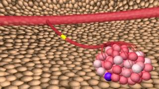 Neuroendocrine Tumors – An Introduction [upl. by Clovis]