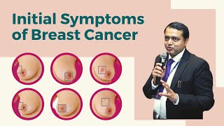 What are the Initial Symptoms of Breast Cancer  Dr Manish Singhal [upl. by Mila]