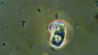 Active Amoeba Feeding [upl. by Eyla]