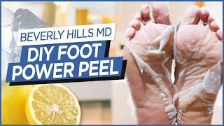 How To Make DIY Foot quotPower Peelquot Easy to make  Beverly Hills MD Beauty Tips [upl. by Steven671]