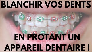 Comment Blanchir Vos Dents en Portant Un Appareil Dentaire [upl. by Hyacinthie]