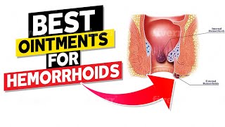 Best Ointments for Hemorrhoids [upl. by Dahlia]