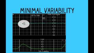 Fetal Measurements Tips and Tricks [upl. by Baiss351]