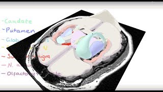 Basal Ganglia 3D Tour [upl. by Moynahan620]