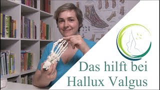 Das hilft bei Hallux Valgus podologinandrea [upl. by Mert]