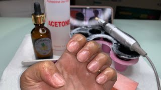 How To Remove Acrylic Nails  Soak Off Nails  Acrylic Nails Removal [upl. by Ailis]